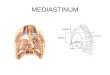 MEDIASTINUM. Was ist das Mediastinum? Mittelfellraum Etym.: latein. = in der Mitte Stehendes; Als Mediastinum wird der Raum zwischen Brustbein und Brustwirbelsäule