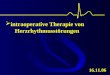intraoperative Therapie von Herzrhythmusstörungen 16.11.06