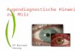 Augendiagnostische Hinweise zur Milz HP Michael Herzog