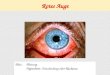 Rotes Auge Blut: Blutung Hyperämie: Entzündung oder Rückstau
