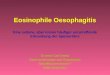 Eosinophile Oesophagitis Eine seltene, aber immer häufiger anzutreffende Erkrankung der Speiseröhre Dr.med. Carl Oneta Gastroenterologie und Hepatologie