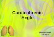 Cardiophrenic angle