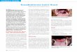 Tonsillektomie beim Hund - Tierklinik · PDF fileDie Blutversorgung der Tonsil-len erfolgt über tonsilläre Äste der Arteria lingualis. Die Äste des Nervus glosso-pharyngicus sorgen