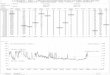 LANGZEIT - EKG - APPARATEGEMEINSCHAFT   Langzeit-EKG-Bericht Seite 5 Patient : Muster Patienten-Nr. : Analyse Datum : 13:02:11 Couplet ( 1-min-HF = 91 ) N N N A A N N N N N N N N
