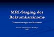 MRI-Staging des Rektumkarzinoms - Radiologie am … Ziel Präoperative Evaluation der Beckenstrukturen Rektum mit M. sphincter ani internusinternus et externus Hypogastrischer und