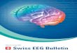 Edition Nr. 10 | April 2016 Swiss EEG Bulletin · Hinsicht des EEG Bulletins, das nun schon stolze ... bien illustré par des exemples en images ! ... 30 secondes d’EEG environ