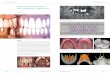 Ästhetische Rekonstruktion nach parodontaler Destruktion · PDF file9003 Verwenden einer Orientierungsschablone/Positionierungsschablone zur praxisspezifisch kalkuliert Implantation,