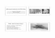 Rheumatoid Arthritis - Handouts - OSU Center for ... - Rheumatoid Arthritis - 4.pdf · • Arthritis in three or more joint areas • Arthritis of hand joints (> 1 swollen joints)