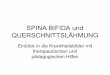 SPINA BIFIDA und QUERSCHNITTSLÄHMUNG - scheel-schule.de Spina Bifida.pdf · Gliederung • 1.Definitionen Spina bifida ,Querschnittslähmung • 2.Ursachen • 3.Zusammenhang •