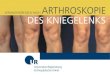 ARTHROSKOPIE - uni-regensburg.de · Damit Sie nach der Arthroskopie und auch im . weiteren Verlauf gut zurechtkommen, sollten Sie einige Grundregeln beachten, die in dieser Broschüre