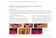 Frölich et al.: Infektionskrankheiten des Feldhasen · dehnte eitrige Bronchopneumonie und eine fibrinös- eitrige Pleuritis und Perikarditis festgestellt (Abb. 5). Die Pasteurellose