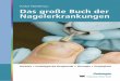 Verlag Neuer Merkur GmbH · 2019-01-30 · Pterygium Mit dieser Dokumentation kann im Bedarfsfall eine optimale Therapieab-sprache interdisziplinär in Zusammenar-beit mit Ärzten