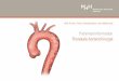 Patienteninformation Thorakale Aortenchirurgie · es zum Riss (Ruptur) der Aorta kommen.Eine notfallmäßige chirurgische Behandlung ist dann unumgänglich. Akute Aortenerkrankungen