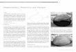 Plagiocephalus: Prävention und Therapie · Questions au spécialiste / Fragen an den Spezialisten Vol. 13 No. 4 2002 24 Plagiocephalus: Prävention und Therapie Frage «Orthopäden