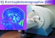 9) Kernspintomographie (MRI) · Zeeman Effekt H externes Magnetfeld Probe Magnetisierung = Zusatzfeld Chemische Verschiebung. 8 7 6 5 4 3 2 1 0 =CH2 CH2-CH3 TMS schwächere Abschirmung