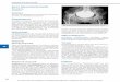 40.4.5 Rheumatische Koxitis - bilder.buecher.de · Die Spondylitis ankylosans zeigt der Coxitis tuberculosa ähnelnde stark destruierende (ankylosierende) Verände-rungen. Ein MRT