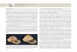 Weichtiere (Mollusca - lau.sachsen-anhalt.de · 564 Buttstedt, L. (2007): Wiederfund einer Restpopula-tion der abgeplatteten Teichmuschel Pseudanodonta complanata (Rossmässler, 1835)