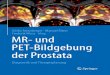 MR- und PET-Bildgebung der Prostata - download.e- · PDF fileKlinik für Urologie, Universitätsmedizin Mannheim, Med. Fakultät Mannheim der Universität Heidelberg, Mannheim Frederik