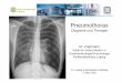 Diagnose und Therapie M. Vogtmann - leipzig-kardiologie.de · Spannungspneumothorax und bilateraler Pneumothorax sind lebensbedrohliche Notfälle und erfordern ein sofortiges Handeln!