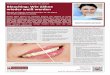 Bleaching: Wie Zähne wieder weiß werden · Power-leaching in der Zahnarzt-Praxis. Beim Home-Bleaching werden von uns dünne flexible Formen aus einem transpa-renten Kunststoff hergestellt,