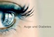 Auge und Diabetes - friederike-bischof.de · Augenerkrankungen bei Diabetes mellitus •Retinopathie und Makulopathie •Traktionsablatio •Rubeosis Iridis und neovaskuläres Glaukom
