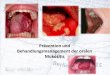 Prävention und Behandlungsmanagement der oralen Mukositis · Prävention und Behandlungsmanagement der oralen Mukositis Einleitung Pathophysiologie Lebensqualität Risikofaktoren