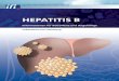 HEPATITIS B - ifi-medizin.de · Hepatitis B weiterhin eine nicht einfach zu behandelnde Erkran - kung, die von Ihnen auch viel Geduld verlangt. Häufigkeit der Hepatitis B Da sehr