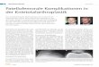 ENDOPROTHETIK REFERAT Patellofemorale Komplikationen in ... · I Seite 6 Orthopädie & Rheumatologie 2/15 ENDOPROTHETIK REFERAT Patellofemorale Komplikationen in der Knietotalarthroplastik