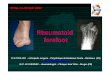 rheumatoid forefoot - Pied€¦ · The rheumatoid arthritis ( RA) is an autoimmune disorder which touchs the foot in 70% of the cases. 30% of the RA will be discover by a foot deformity