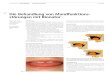 Die Behandlung von Mundfunktions- örungen mit Bionator · 2015-08-08 · Der Bionator bewirkt die Erweiterung des Mundraumes und bringt die Zunge dazu, sich an den richtigen Ort