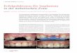 Erfolgsfaktoren für Implantate in der ästhetischen … › epaper › sim › cd › 2017 › cd0217 › ...Fachbeitrag cosmetic dentistry cosmetic 17 dentistr 2 2017Fall 3 – Der