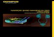 NARROW BAND IMAGING IN DER UROLOGIE - …...2013/10/31  · 3 HD-NBI: Deutliche verbesserter Kontrast der Mukosa- und Gefäßstruktur durch Filterung des weißen Lichts Exzellente