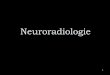Neuroradiologie - ConnexenceAngle pontocérébelleux Sinus sphénoïdal 5. Tronc basilaire Quatrième ventricule Protubérance cervelet Lobe temporal 6. Sinus frontal Tente du cervelet
