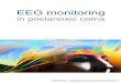 EEG monitoring in postanoxic coma · formation regarding recovery from postanoxic coma. Several studies indicated that EEG monitoring might have a role in the progno-sis of neurological
