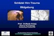 Schädel Hirn Trauma Bildgebung - DGNC · PDF file Schädel Hirn Trauma . Bildgebung . Prof. Dr.Bodo Kress . Abteilung Neuroradiologie . Krankenhaus Frankfurt NW . Abt. Neuroradiologie,