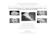 Quantitative CT des Kniegelenks zur Arthrosediagnostik...femoropatellaris). • dem Kniekehlengelenk zwischen den Femurkondylen und dem Schienbeinknochen (Articulatio femorotibialis)