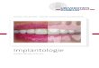 Implantologie - uniklinik-freiburg.de...4 Einleitung Im Laufe des Lebens können Zähne durch verschiedene Ursachen wie z.B. Unfälle, Entzündungen (Parodontitis), Zysten, Fehlbildungen
