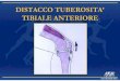 DISTACCO TUBEROSITA’ TIBIALE ANTERIORE · 2016. 1. 7. · Microsoft PowerPoint - SISCA STAGE SPORTILIA 2005.ppt Author: grassig Created Date: 2/28/2006 8:06:34 AM 