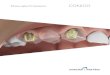Manuale Protesico CONICO - Sweden & Martina · 2020. 5. 29. · La protesi conometrica è da ritenersi una protesi fissa, al pari delle soluzioni avvitate e cementate e ne racchiude