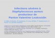Panton & Valentine Leukocidin (PVL) - Infectiologie
